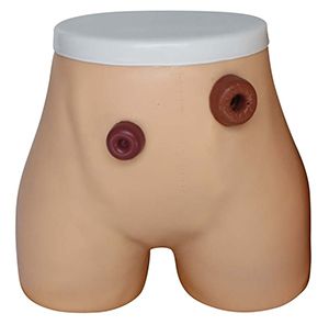 Ostomy Nursing Model